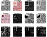 MedMNIST: 一个大规模轻量级��的2D和3D生物医学图像分类基准数据集
