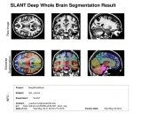 SLANTbrainSeg:基于深度学习的全脑高分辨率分割方法