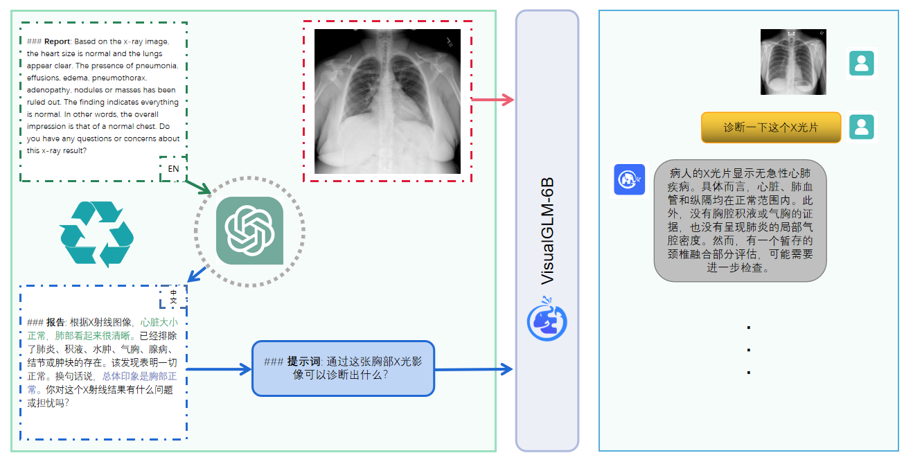 XrayGLM模型架构