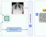 XrayGLM：首个会看胸部X光片的中文多模态医学大模型